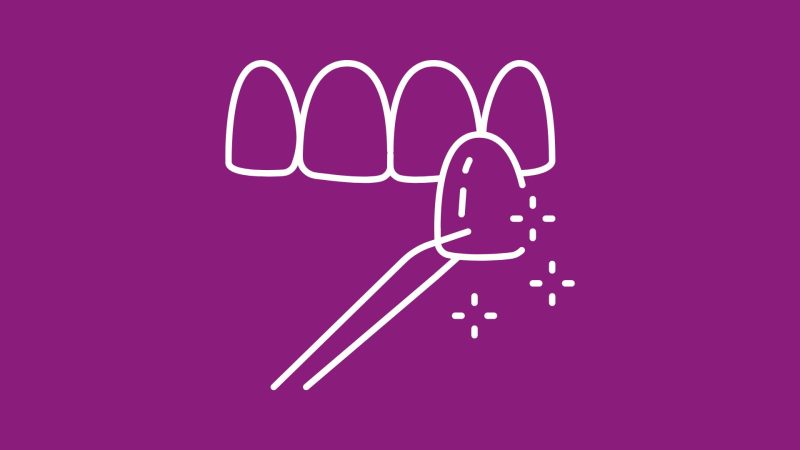 porcelain veneers icon