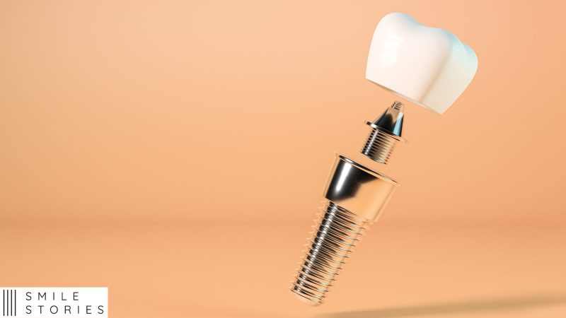 Single Dental Implant Southampton - titanium implant - abutment and crown on an orange background