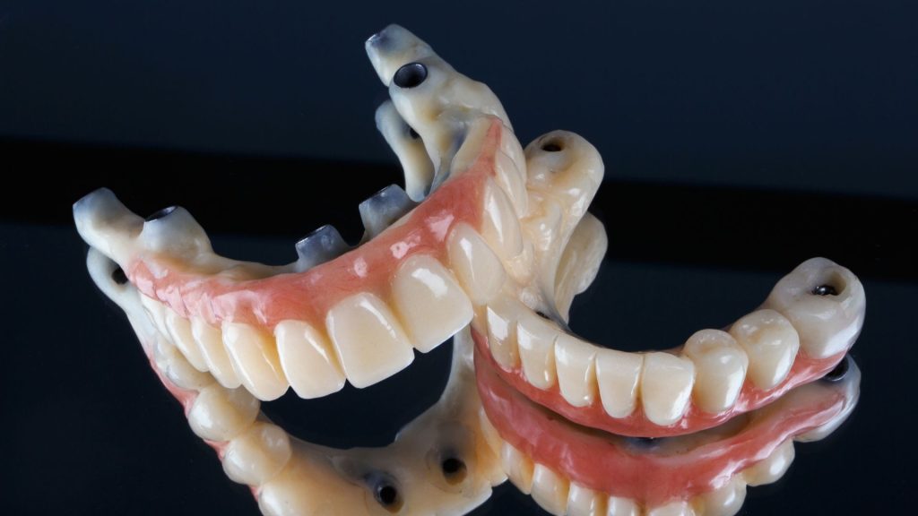 all on 4 dental implants Southampton