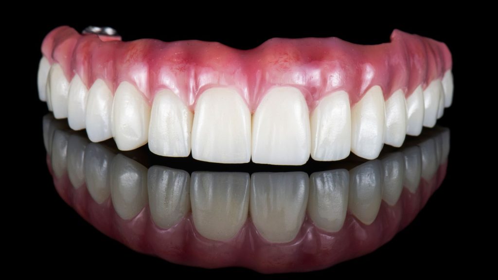 Denture implants for seniors in Yeovil