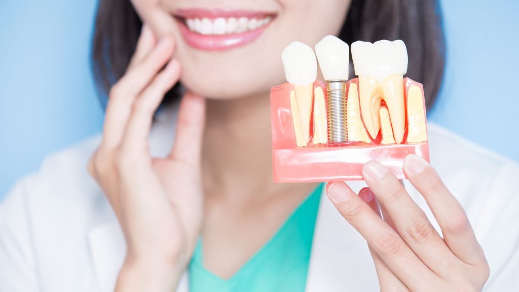 a female dentist holding a model of a single tooth dental implant - she has a big smile