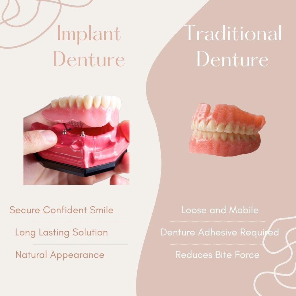 Benefits of Denture Implants