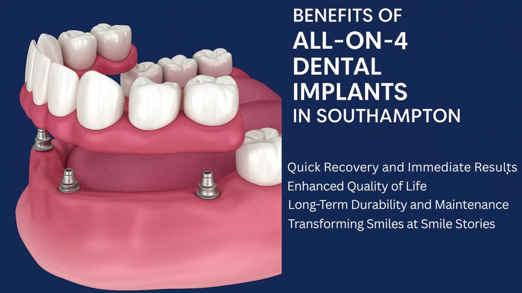 benefits of all-on-4 dental implants Southampton