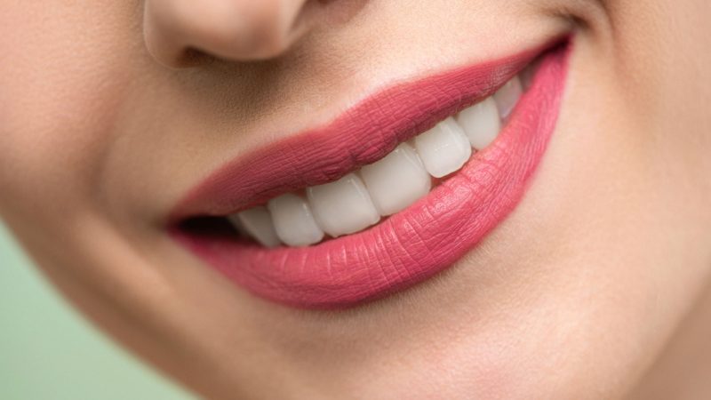 teeth in a day Bournemouth