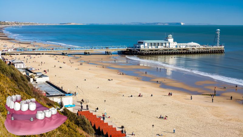 all on 4 dental implants dorset